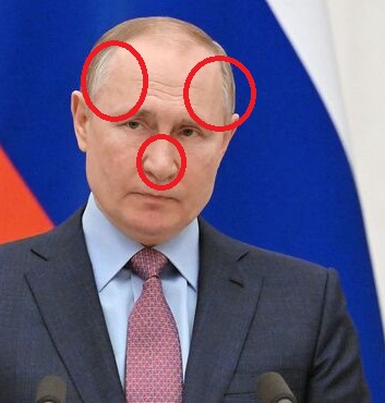 putin post op